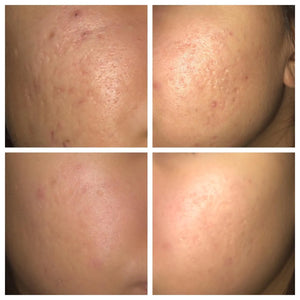 Face Peeling Solution: Skin Care Serum